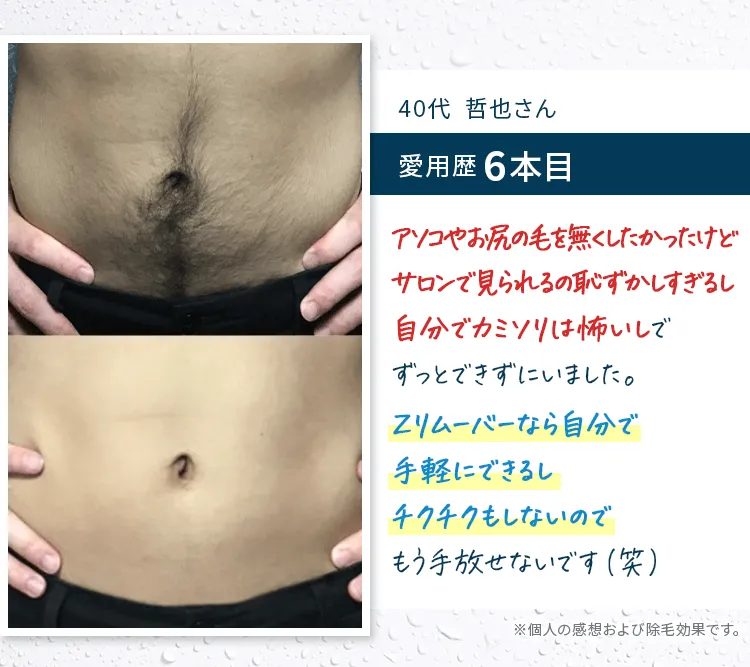 zリムーバー　ATSさま専用 Amazon.co.jp: ZEROFACTOR 薬用 Zリムーバー Z REMOVER 除毛
